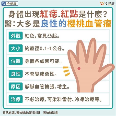 身體上的痣|皮膚長痣、長斑是皮膚癌前兆？皮膚癌初期4大症狀快。